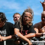 Dying FetusY4110